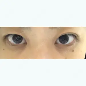 before image