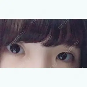 before image