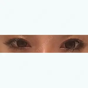 before image