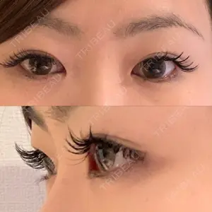 before image