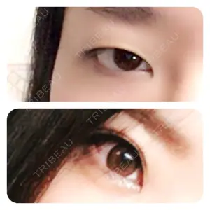 before image