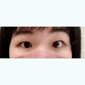 TCB東京中央美容外科 心斎橋筋院の林 弘樹医師口コミ