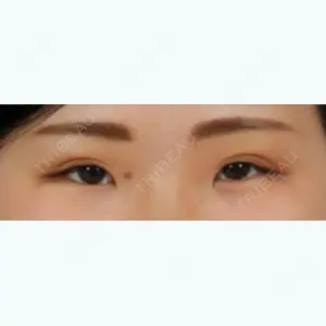 before image