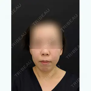 藤・ナチュレ美容クリニック 藤ナチュレスキンクリニック口コミ