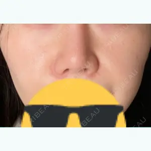 新宿ラクル美容外科クリニックの口コミ