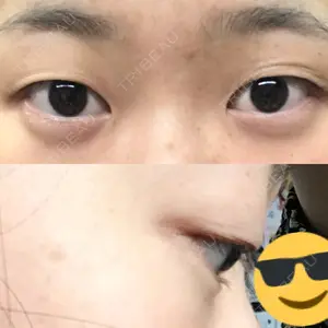 before image