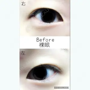 before image