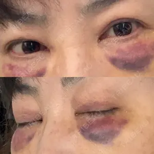 湘南美容クリニック 湘南美容クリニック橋本院口コミ