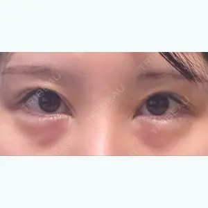エイペックス美容外科のソンヒョンソク医師口コミ
