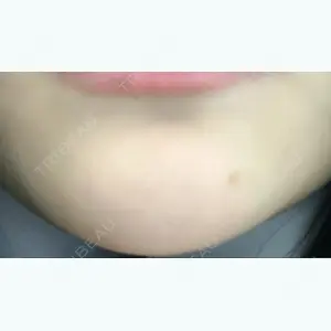 東京中央美容外科・美容皮膚科の口コミ