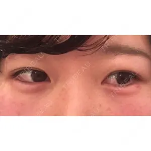 before image