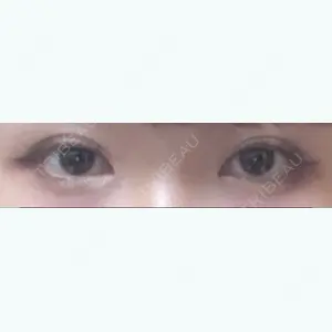 before image