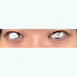 蘇春堂形成外科口コミ