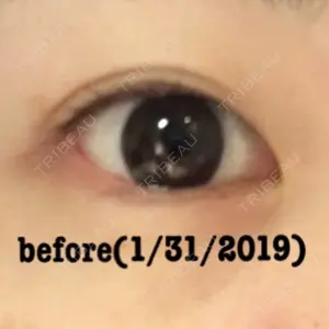 before image