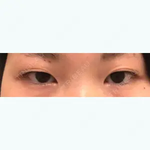 before image