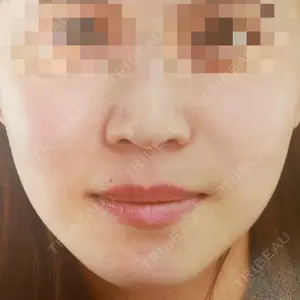 TAクリニック 福岡TAクリニック口コミ