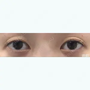 before image