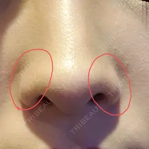 before image