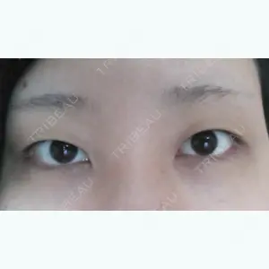 before image