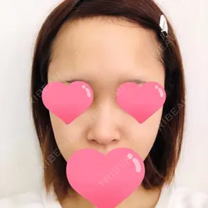 id美容外科のキム・イルファン医師口コミ