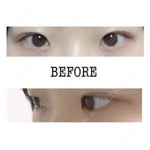 before image