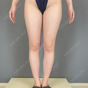 レアート整形外科口コミ