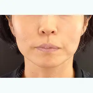 TAクリニック 福岡TAクリニック口コミ