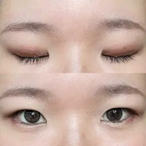 before image