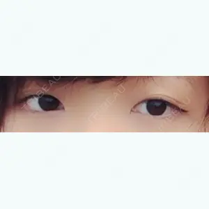 before image