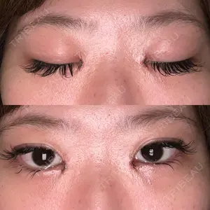 藤・ナチュレ美容クリニック 藤・ナチュレ美容クリニック 恵比寿院口コミ