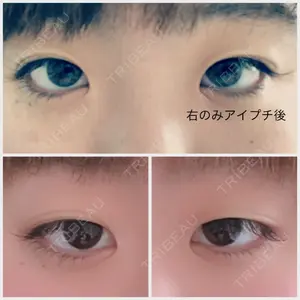 before image
