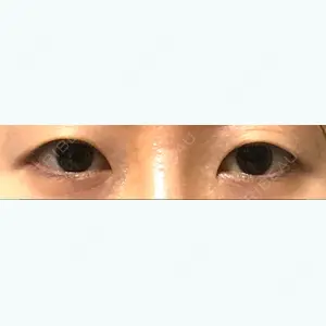 before image