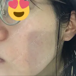湘南美容クリニック 新宿本院の洌鎌紫乃美医師口コミ