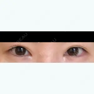 before image