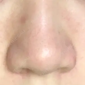 before image