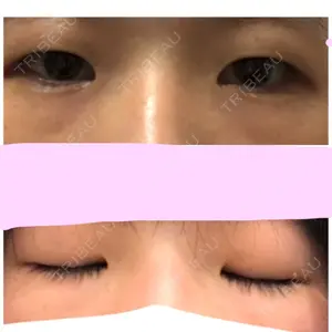 before image