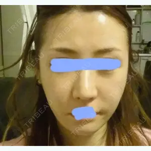 before image