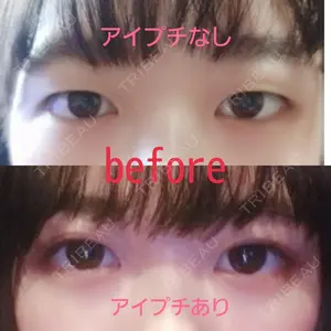 before image