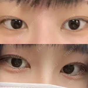 before image