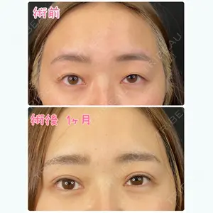 before image