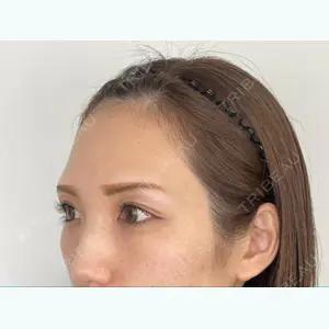 before image