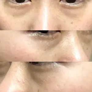 before image