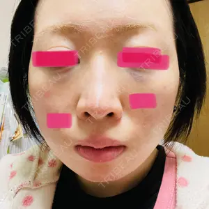 TCB東京中央美容外科 TCB東京中央美容外科 仙台駅前院口コミ