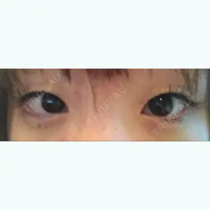 before image