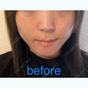 before image
