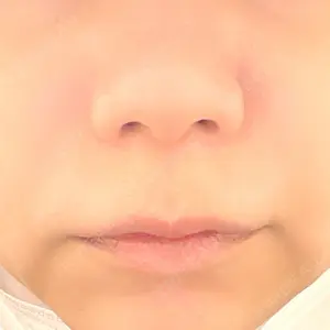 新宿ラクル美容外科クリニック 新宿院の山本厚志医師口コミ