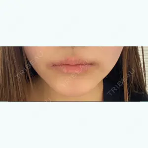 before image