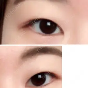before image