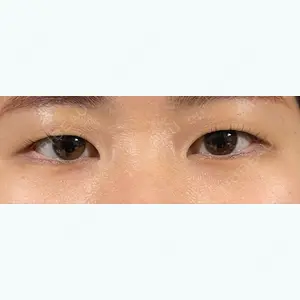 湘南美容クリニック 池袋東口院の赤尾 健医師口コミ