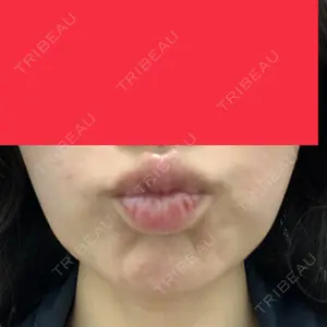 TCB東京中央美容外科 TCB東京中央美容外科 渋谷西口院口コミ
